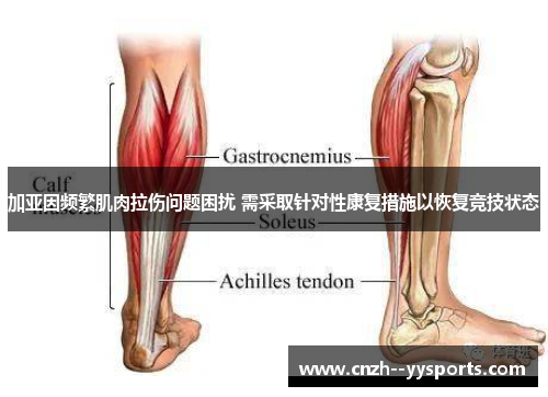 加亚因频繁肌肉拉伤问题困扰 需采取针对性康复措施以恢复竞技状态 加亚因频繁肌肉拉伤问题困扰 需采取针对性康复措施以恢复竞技状态